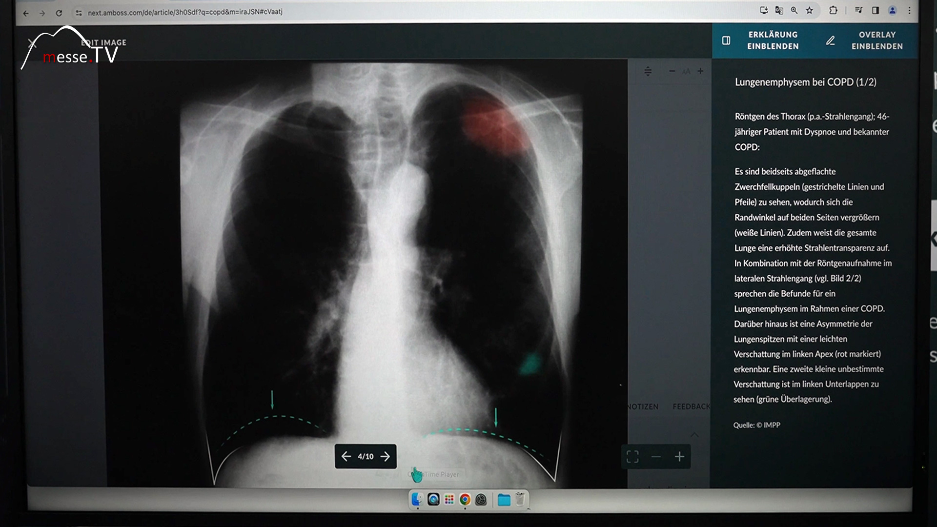 findings clinical picture online medical encyclopedia library amboss